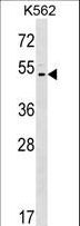 ACCN5 / HINAC Antibody - ACCN5 Antibody western blot of K562 cell line lysates (35 ug/lane). The ACCN5 antibody detected the ACCN5 protein (arrow).