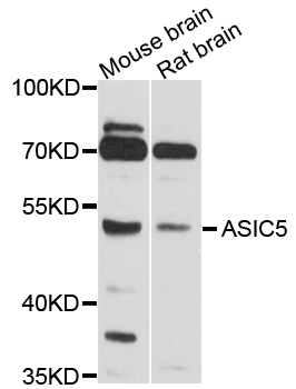 ACCN5 / HINAC Antibody - Western blot analysis of extracts of various cell lines, using ASIC5 antibody at 1:1000 dilution. The secondary antibody used was an HRP Goat Anti-Rabbit IgG (H+L) at 1:10000 dilution. Lysates were loaded 25ug per lane and 3% nonfat dry milk in TBST was used for blocking. An ECL Kit was used for detection and the exposure time was 30s.