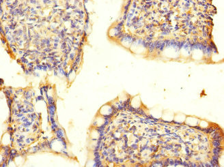 ACCN5 / HINAC Antibody - Immunohistochemistry of paraffin-embedded human small intestine at dilution 1:100