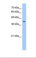ACCS / ACS Antibody - HepG2 cell lysate. Antibody concentration: 2.5 ug/ml. Gel concentration: 12%.  This image was taken for the unconjugated form of this product. Other forms have not been tested.