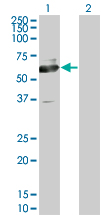 ACCS / ACS Antibody - Western blot of PHACS expression in transfected 293T cell line by PHACS monoclonal antibody (M02), clone 1D2.