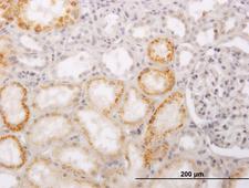 ACCS / ACS Antibody - Immunoperoxidase of monoclonal antibody to PHACS on formalin-fixed paraffin-embedded human kidney (antibody concentration 3 ug/ml).