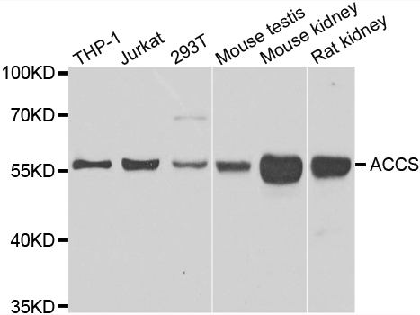 ACCS / ACS Antibody - Western blot analysis of extracts of various cell lines.