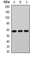 ACCS / ACS Antibody - Western blot analysis of PHACS expression in Jurkat (A); mouse testis (B); rat kidney (C) whole cell lysates.