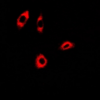 ACCS / ACS Antibody - Immunofluorescent analysis of PHACS staining in A549 cells. Formalin-fixed cells were permeabilized with 0.1% Triton X-100 in TBS for 5-10 minutes and blocked with 3% BSA-PBS for 30 minutes at room temperature. Cells were probed with the primary antibody in 3% BSA-PBS and incubated overnight at 4 deg C in a humidified chamber. Cells were washed with PBST and incubated with a DyLight 594-conjugated secondary antibody (red) in PBS at room temperature in the dark.