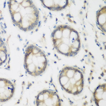ACCS / ACS Antibody - Immunohistochemistry of paraffin-embedded human colon using ACCS antibody at dilution of 1:200 (40x lens).