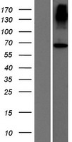 ACCSL Protein - Western validation with an anti-DDK antibody * L: Control HEK293 lysate R: Over-expression lysate