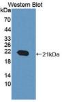 ACD / PTOP Antibody - Western blot of ACD / PTOP antibody.