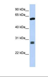 ACD / PTOP Antibody - Fetal brain lysate. Antibody concentration: 1.0 ug/ml. Gel concentration: 12%.  This image was taken for the unconjugated form of this product. Other forms have not been tested.