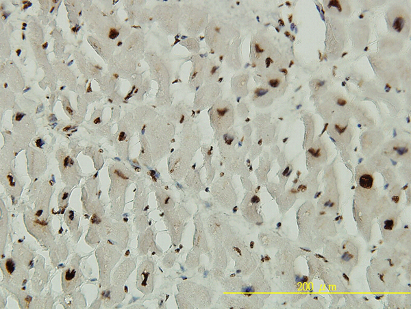 ACD / PTOP Antibody - Immunoperoxidase of monoclonal antibody to ACD on formalin-fixed paraffin-embedded human heart tissue. [antibody concentration 2 ug/ml].