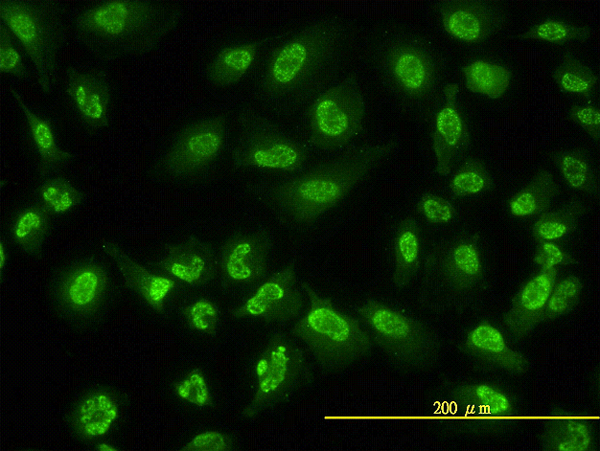 ACD / PTOP Antibody - Immunofluorescence of monoclonal antibody to ACD on HeLa cell. [antibody concentration 10 ug/ml]