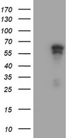 ACD / PTOP Antibody - HEK293T cells were transfected with the pCMV6-ENTRY control (Left lane) or pCMV6-ENTRY ACD (Right lane) cDNA for 48 hrs and lysed. Equivalent amounts of cell lysates (5 ug per lane) were separated by SDS-PAGE and immunoblotted with anti-ACD.
