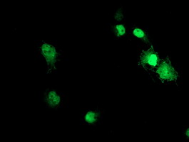 ACD / PTOP Antibody - Anti-ACD mouse monoclonal antibody immunofluorescent staining of COS7 cells transiently transfected by pCMV6-ENTRY ACD.