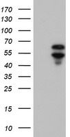 ACD / PTOP Antibody - HEK293T cells were transfected with the pCMV6-ENTRY control (Left lane) or pCMV6-ENTRY ACD (Right lane) cDNA for 48 hrs and lysed. Equivalent amounts of cell lysates (5 ug per lane) were separated by SDS-PAGE and immunoblotted with anti-ACD.