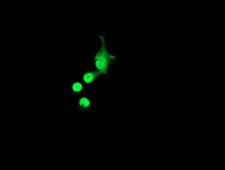 ACD / PTOP Antibody - Anti-ACD mouse monoclonal antibody immunofluorescent staining of COS7 cells transiently transfected by pCMV6-ENTRY ACD.