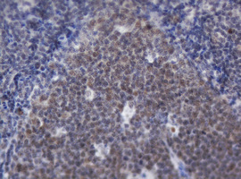ACD / PTOP Antibody - IHC of paraffin-embedded Human lymph node tissue using anti-ACD mouse monoclonal antibody.