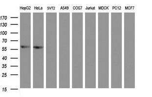 ACD / PTOP Antibody - Western blot of extracts (35 ug) from 9 different cell lines by using g anti-ACD monoclonal antibody (HepG2: human; HeLa: human; SVT2: mouse; A549: human; COS7: monkey; Jurkat: human; MDCK: canine; PC12: rat; MCF7: human).