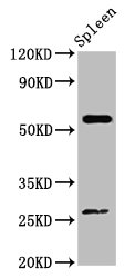 ACD / PTOP Antibody - Positive Western Blot detected in Mouse spleen tissue. All lanes: ACD antibody at 4 µg/ml Secondary Goat polyclonal to rabbit IgG at 1/50000 dilution. Predicted band size: 58 KDa. Observed band size: 58 KDa
