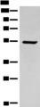 ACD / PTOP Antibody - Western blot analysis of HEPG2 cell lysate  using ACD Polyclonal Antibody at dilution of 1:400