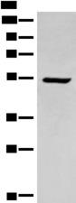 ACD / PTOP Antibody - Western blot analysis of HEPG2 cell lysate  using ACD Polyclonal Antibody at dilution of 1:400