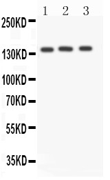 ACE / CD143 Antibody - ACE antibody Western blot. All lanes: Anti ACE at 0.5 ug/ml. Lane 1: A549 Whole Cell Lysate at 40 ug. Lane 2: HELA Whole Cell Lysate at 40 ug. Lane 3: 22RV1 Whole Cell Lysate at 40 ug. Predicted band size: 150 kD. Observed band size: 150 kD.