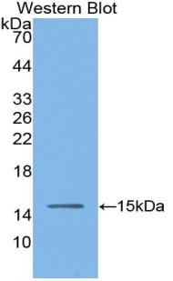 ACE / CD143 Antibody - Western blot of ACE / CD143 antibody.