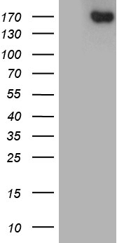ACE / CD143 Antibody - HEK293T cells were transfected with the pCMV6-ENTRY control. (Left lane) or pCMV6-ENTRY ACE. (Right lane) cDNA for 48 hrs and lysed. Equivalent amounts of cell lysates. (5 ug per lane) were separated by SDS-PAGE and immunoblotted with anti-ACE. (1:2000)