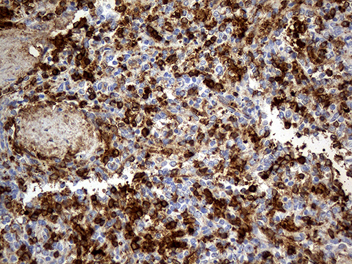 ACE / CD143 Antibody - Immunohistochemical staining of paraffin-embedded Human spleen tissue within the normal limits using anti-ACE mouse monoclonal antibody. (Heat-induced epitope retrieval by 1mM EDTA in 10mM Tris buffer. (pH8.5) at 120°C for 3 min. (1:500)