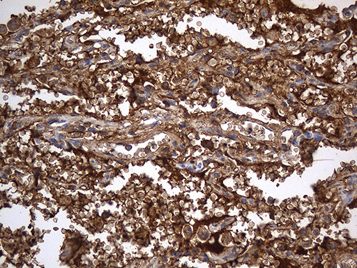 ACE / CD143 Antibody - Immunohistochemical staining of paraffin-embedded Human lung tissue within the normal limits using anti-ACE mouse monoclonal antibody. (Heat-induced epitope retrieval by 1mM EDTA in 10mM Tris buffer. (pH8.5) at 120°C for 3 min. (1:500)