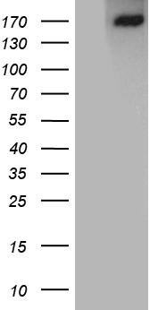 ACE / CD143 Antibody - HEK293T cells were transfected with the pCMV6-ENTRY control. (Left lane) or pCMV6-ENTRY ACE. (Right lane) cDNA for 48 hrs and lysed. Equivalent amounts of cell lysates. (5 ug per lane) were separated by SDS-PAGE and immunoblotted with anti-ACE. (1:500)