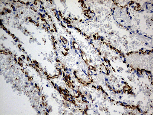 ACE / CD143 Antibody - Immunohistochemical staining of paraffin-embedded Human lung tissue within the normal limits using anti-ACE mouse monoclonal antibody. (Heat-induced epitope retrieval by 1mM EDTA in 10mM Tris buffer. (pH8.5) at 120°C for 3 min. (1:500)