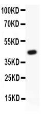 ACE / CD143 Antibody - ACE antibody Western blot. All lanes: Anti ACE at 0.5 ug/ml. WB: Recombinant Human ACE Protein 0.5ng. Predicted band size: 47 kD. Observed band size: 47 kD.