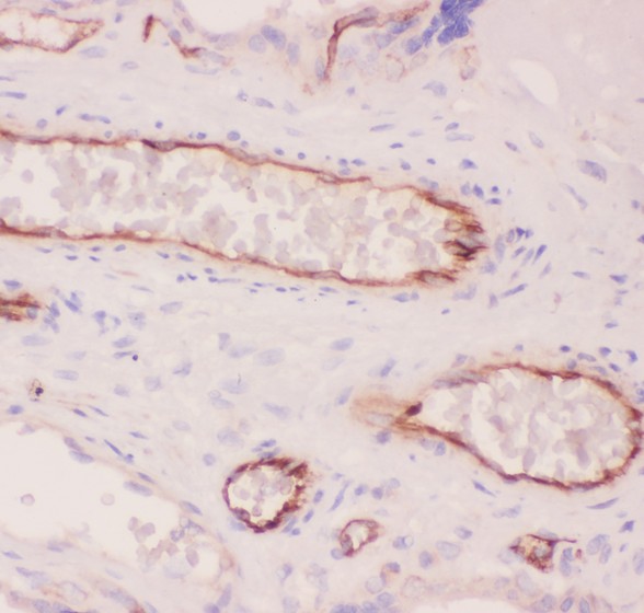 ACE / CD143 Antibody - ACE antibody IHC-paraffin: Human Placenta Tissue.