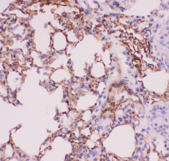 ACE / CD143 Antibody - ACE antibody IHC-paraffin: Mouse Lung Tissue.