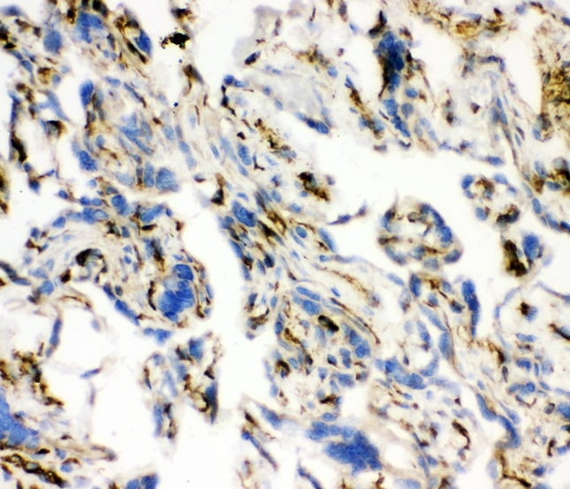 ACE / CD143 Antibody - IHC analysis of ACE using anti-ACE antibody. ACE was detected in frozen section of human placenta tissues. Heat mediated antigen retrieval was performed in citrate buffer (pH6, epitope retrieval solution) for 20 mins. The tissue section was blocked with 10% goat serum. The tissue section was then incubated with 1µg/ml rabbit anti-ACE Antibody overnight at 4°C. Biotinylated goat anti-rabbit IgG was used as secondary antibody and incubated for 30 minutes at 37°C. The tissue section was developed using Strepavidin-Biotin-Complex (SABC) with DAB as the chromogen.