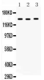 ACE / CD143 Antibody - anti-ACE antibody, Western blotting All lanes: Anti Angiotensin Converting Enzyme 1 at 0.5ug/ml Lane 1: HELA Whole Cell Lysate at 40ugLane 2: A549 Whole Cell Lysate at 40ugLane 3: 22RV1 Whole Cell Lysate at 40ugPredicted bind size: 150KD Observed bind size: 150KD