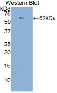 ACE / CD143 Antibody - Western blot of recombinant ACE / DCP1 / CD143.  This image was taken for the unconjugated form of this product. Other forms have not been tested.