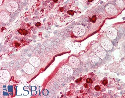 ACE / CD143 Antibody - Human Small Intestine: Formalin-Fixed, Paraffin-Embedded (FFPE).  This image was taken for the unconjugated form of this product. Other forms have not been tested.