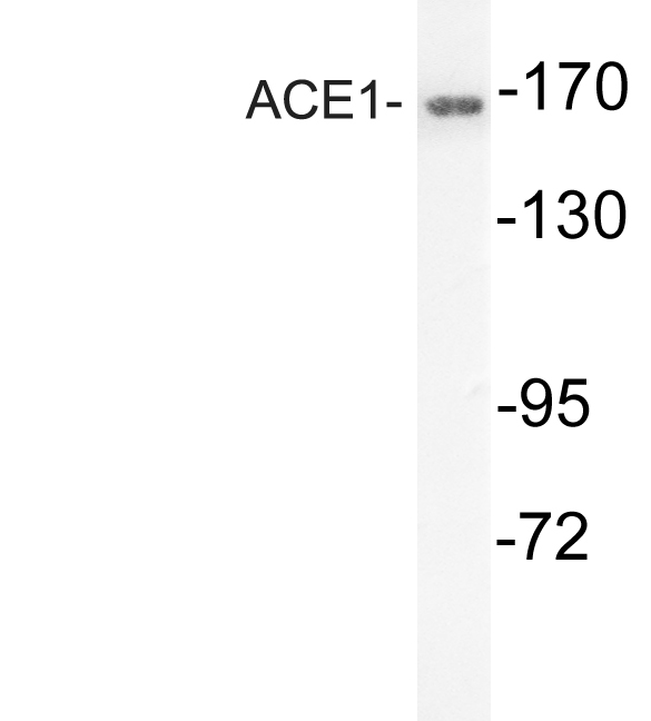 ACE / CD143 Antibody - Western blot analysis of lysates from mouse kidney, using ACE1 antibody.