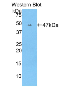 ACE / CD143 Antibody - Western blot of recombinant ACE / DCP1 / CD143.  This image was taken for the unconjugated form of this product. Other forms have not been tested.