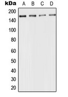 ACE / CD143 Antibody - Western blot analysis of CD143 expression in HeLa (A); mouse kidney (B); rat liver (C); PC12 (D) whole cell lysates.
