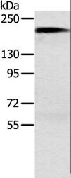 ACE / CD143 Antibody - Western blot analysis of Mouse kidney tissue, using ACE Polyclonal Antibody at dilution of 1:1000.
