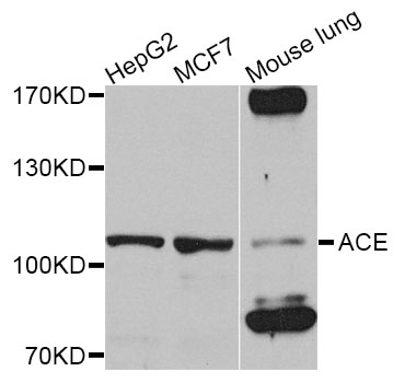 ACE / CD143 Antibody - Western blot analysis of extracts of various cell lines.