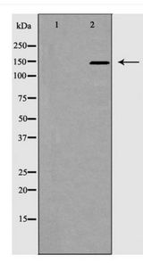 ACE / CD143 Antibody - Western blot of ACE1 expression in mouse kidney