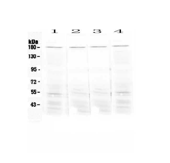 ACE / CD143 Antibody - Western blot - Anti-Ace/Cd143 Picoband antibody
