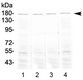 ACE / CD143 Antibody - Western blot testing of 1) mouse lung, 2) mouse testis, 3) mouse stomach and 4) rat lung tissue lysate with Ace antibody at 0.5ug/ml. Expected molecular weight 140-170 kDa.