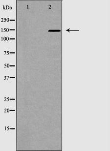ACE / CD143 Antibody - Western blot analysis of ACE1 expression in mouse kidney. The lane on the left is treated with the antigen-specific peptide.