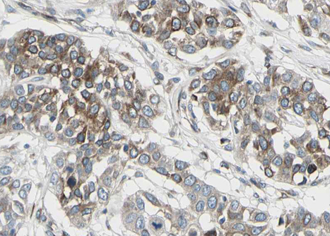 ACE / CD143 Antibody - 1:100 staining human lung tissue by IHC-P. The tissue was formaldehyde fixed and a heat mediated antigen retrieval step in citrate buffer was performed. The tissue was then blocked and incubated with the antibody for 1.5 hours at 22°C. An HRP conjugated goat anti-rabbit antibody was used as the secondary.