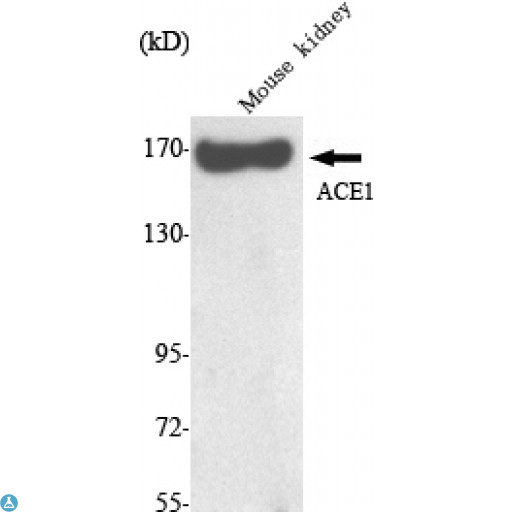 ACE / CD143 Antibody - Western Blot (WB) analysis using ACE1 Monoclonal Antibody against Mouse Kidney lysate.
