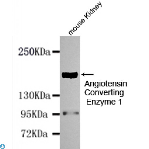 ACE / CD143 Antibody - Western blot detection of Angiotensin Converting Enzyme 1 in Mouse kidney cell lysates using Angiotensin Converting Enzyme 1 mouse mAb (1:1000 diluted). Predicted band size: 150KDa. Observed band size: 190KDa.